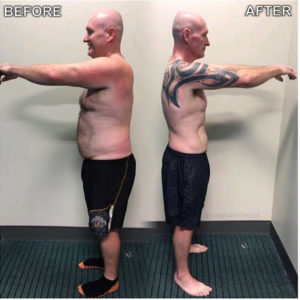 Rod Feilding before after